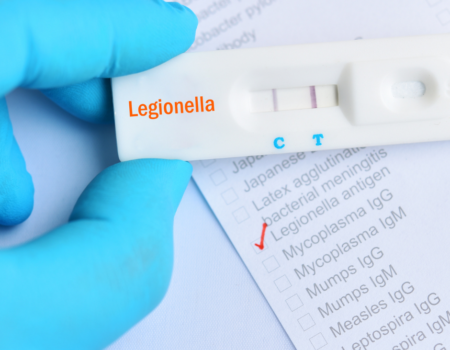 What Is A Legionella Risk Assessment?